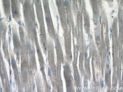 ZAK Rabbit anti-Human, Mouse, Rat, Polyclonal, Proteintech 20 &mu;L; Unconjugated:Antibodies,