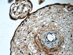 ZAK Rabbit anti-Human, Mouse, Rat, Polyclonal, Proteintech 20 &mu;L; Unconjugated:Antibodies,