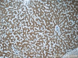 ZAK Rabbit anti-Human, Mouse, Rat, Polyclonal, Proteintech 20 &mu;L; Unconjugated:Antibodies,