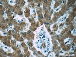 ZAK Rabbit anti-Human, Mouse, Rat, Polyclonal, Proteintech 20 &mu;L; Unconjugated:Antibodies,