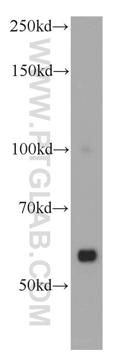 ZAK Rabbit anti-Human, Mouse, Rat, Polyclonal, Proteintech 20 &mu;L; Unconjugated:Antibodies,