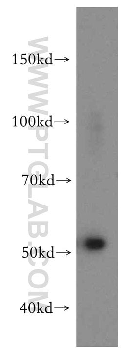 ZAK Rabbit anti-Human, Mouse, Rat, Polyclonal, Proteintech 20 &mu;L; Unconjugated:Antibodies,