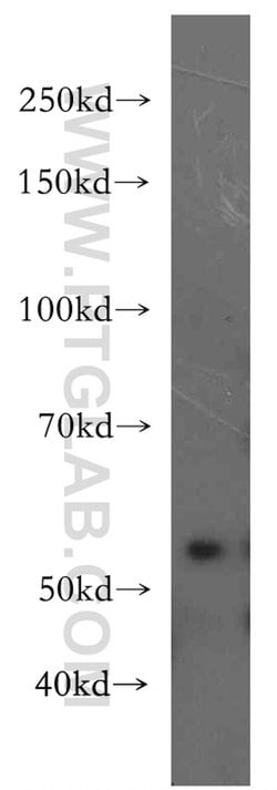 ZAK Rabbit anti-Human, Mouse, Rat, Polyclonal, Proteintech 20 &mu;L; Unconjugated:Antibodies,