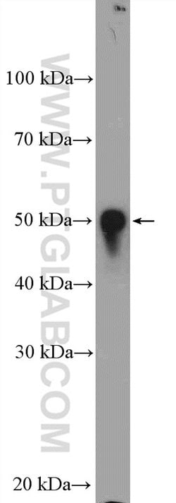 ZAK Rabbit anti-Human, Mouse, Rat, Polyclonal, Proteintech 20 &mu;L; Unconjugated:Antibodies,