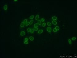 Cyclon/CCDC86 Rabbit anti-Human, Mouse, Rat, Polyclonal, Proteintech 150