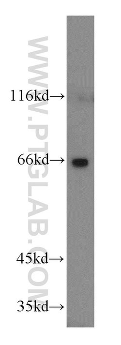 Cyclon/CCDC86 Rabbit anti-Human, Mouse, Rat, Polyclonal, Proteintech 150