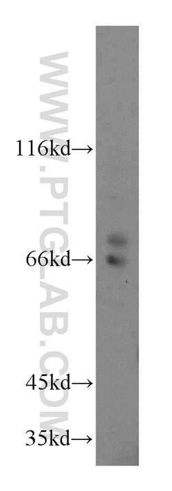 Cyclon/CCDC86 Rabbit anti-Human, Mouse, Rat, Polyclonal, Proteintech 150