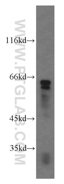 Cyclon/CCDC86 Rabbit anti-Human, Mouse, Rat, Polyclonal, Proteintech 150