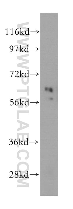 Cyclon/CCDC86 Rabbit anti-Human, Mouse, Rat, Polyclonal, Proteintech 150