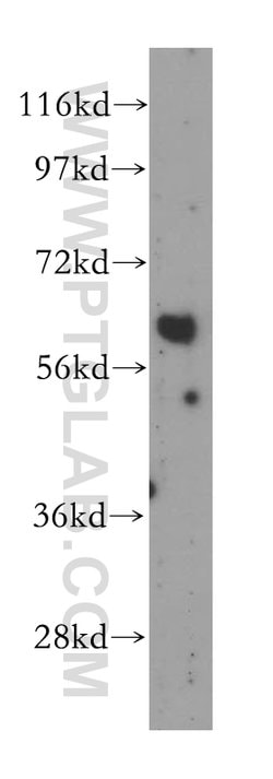 Cyclon/CCDC86 Rabbit anti-Human, Mouse, Rat, Polyclonal, Proteintech 150