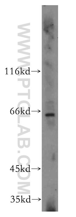 Cyclon/CCDC86 Rabbit anti-Human, Mouse, Rat, Polyclonal, Proteintech 150