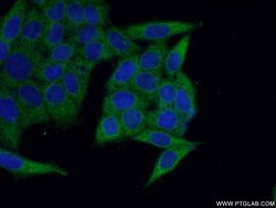 KARS Rabbit anti-Human, Mouse, Rat, Polyclonal, Proteintech 150 &mu;L;