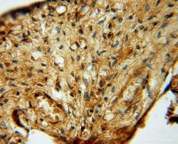 KARS Rabbit anti-Human, Mouse, Rat, Polyclonal, Proteintech 150 &mu;L;