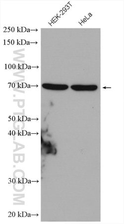 KARS Rabbit anti-Human, Mouse, Rat, Polyclonal, Proteintech 150 &mu;L;