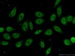 Thumbnail_RBM8A/Y14 Rabbit anti-Human, Mouse, Rat, Polyclonal, Proteintech 150 &mu;L;