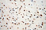 Thumbnail_RBM8A/Y14 Rabbit anti-Human, Mouse, Rat, Polyclonal, Proteintech 150 &mu;L;