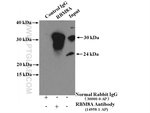 Thumbnail_RBM8A/Y14 Rabbit anti-Human, Mouse, Rat, Polyclonal, Proteintech 150 &mu;L;