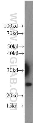 Thumbnail_RBM8A/Y14 Rabbit anti-Human, Mouse, Rat, Polyclonal, Proteintech 150 &mu;L;