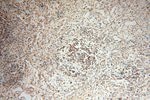 Thumbnail_RBM8A/Y14 Rabbit anti-Human, Mouse, Rat, Polyclonal, Proteintech 150 &mu;L;