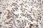 Thumbnail_RBM8A/Y14 Rabbit anti-Human, Mouse, Rat, Polyclonal, Proteintech 150 &mu;L;