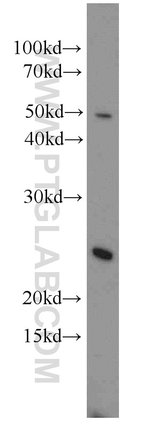Thumbnail_RBM8A/Y14 Rabbit anti-Human, Mouse, Rat, Polyclonal, Proteintech 150 &mu;L;