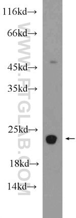 Thumbnail_RBM8A/Y14 Rabbit anti-Human, Mouse, Rat, Polyclonal, Proteintech 150 &mu;L;