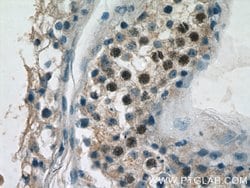 RAD51 Rabbit anti-Human, Mouse, Polyclonal, Proteintech:Antibodies:Primary