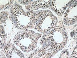 RAD51 Rabbit anti-Human, Mouse, Polyclonal, Proteintech:Antibodies:Primary
