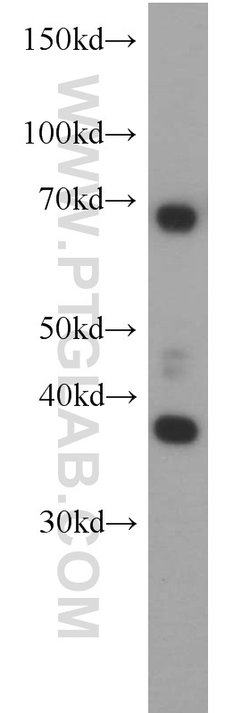 RAD51 Rabbit anti-Human, Mouse, Polyclonal, Proteintech:Antibodies:Primary