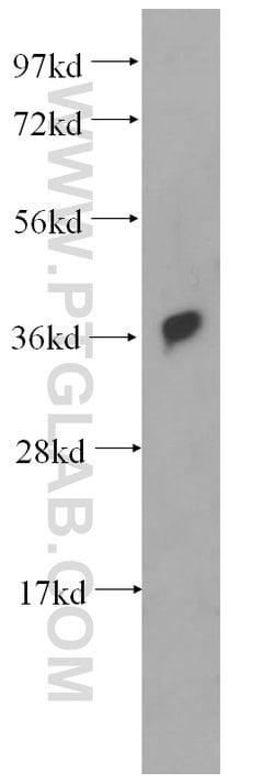 RAD51 Rabbit anti-Human, Mouse, Polyclonal, Proteintech:Antibodies:Primary