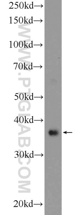 RAD51 Rabbit anti-Human, Mouse, Polyclonal, Proteintech:Antibodies:Primary