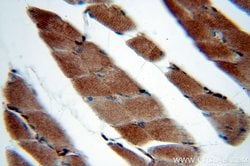 SERPINB6 Rabbit anti-Human, Mouse, Polyclonal, Proteintech:Antibodies:Primary