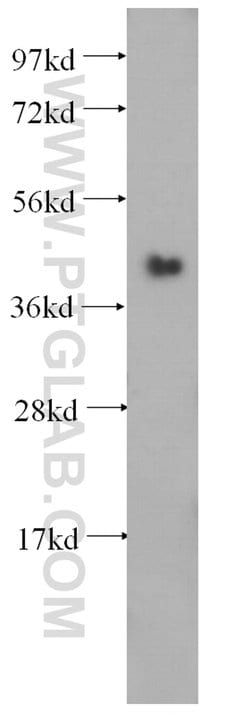 SERPINB6 Rabbit anti-Human, Mouse, Polyclonal, Proteintech:Antibodies:Primary