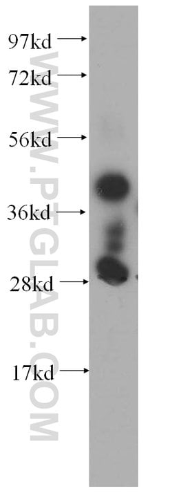 SERPINB6 Rabbit anti-Human, Mouse, Polyclonal, Proteintech:Antibodies:Primary