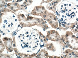 SLC25A39 Rabbit anti-Human, Mouse, Polyclonal, ProteinTech 150 &mu;L; Unconjugated:Antibodies,