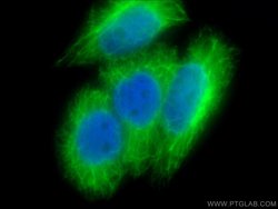 Cytokeratin 19 Rabbit anti-Human, Polyclonal, Proteintech 150 &mu;L; Unconjugated:Antibodies,