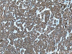 Cytokeratin 19 Rabbit anti-Human, Polyclonal, Proteintech 150 &mu;L; Unconjugated:Antibodies,