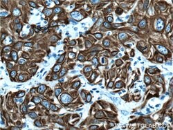 Cytokeratin 19 Rabbit anti-Human, Polyclonal, Proteintech 150 &mu;L; Unconjugated:Antibodies,