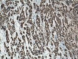 Cytokeratin 19 Rabbit anti-Human, Polyclonal, Proteintech 150 &mu;L; Unconjugated:Antibodies,
