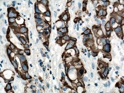 Cytokeratin 19 Rabbit anti-Human, Polyclonal, Proteintech 150 &mu;L; Unconjugated:Antibodies,