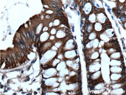 Cytokeratin 19 Rabbit anti-Human, Polyclonal, Proteintech 150 &mu;L; Unconjugated:Antibodies,