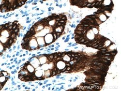 Cytokeratin 19 Rabbit anti-Human, Polyclonal, Proteintech 150 &mu;L; Unconjugated:Antibodies,