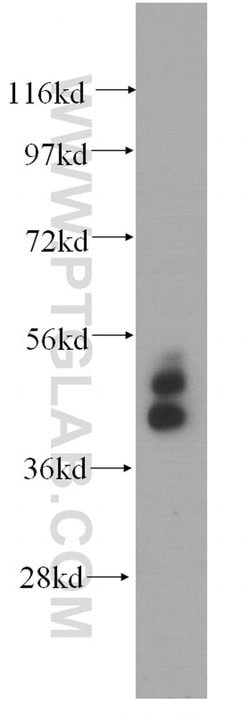 Cytokeratin 19 Rabbit anti-Human, Polyclonal, Proteintech 150 &mu;L; Unconjugated:Antibodies,