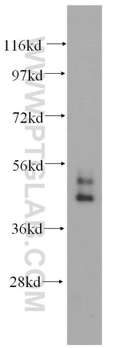 Cytokeratin 19 Rabbit anti-Human, Polyclonal, Proteintech 150 &mu;L; Unconjugated:Antibodies,