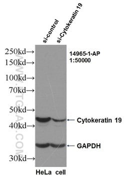 Cytokeratin 19 Rabbit anti-Human, Polyclonal, Proteintech 150 &mu;L; Unconjugated:Antibodies,