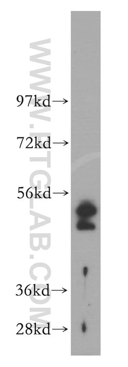 Cytokeratin 19 Rabbit anti-Human, Polyclonal, Proteintech 150 &mu;L; Unconjugated:Antibodies,