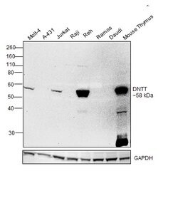 Invitrogen TdT Monoclonal Antibody (7UNA8U6), eBioscience , Invitrogen