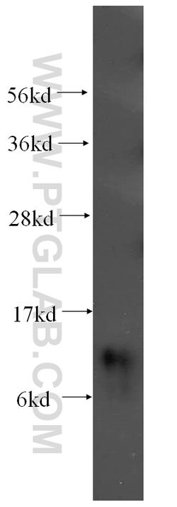 SNRPF Rabbit anti-Human, Mouse, Rat, Polyclonal, Proteintech 20 &mu;L | Buy Online | Proteintech | Fisher Scientific