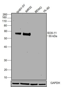 SOX11 Monoclonal Antibody (SOX11-C1), eBioscience , Invitrogen:Antibodies:Primary