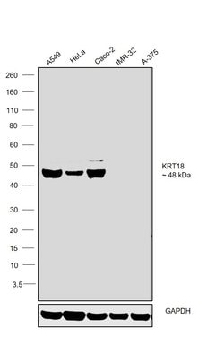 Cytokeratin 18 Monoclonal Antibody (LDK18), eBioscience , Invitrogen:Antibodies:Primary